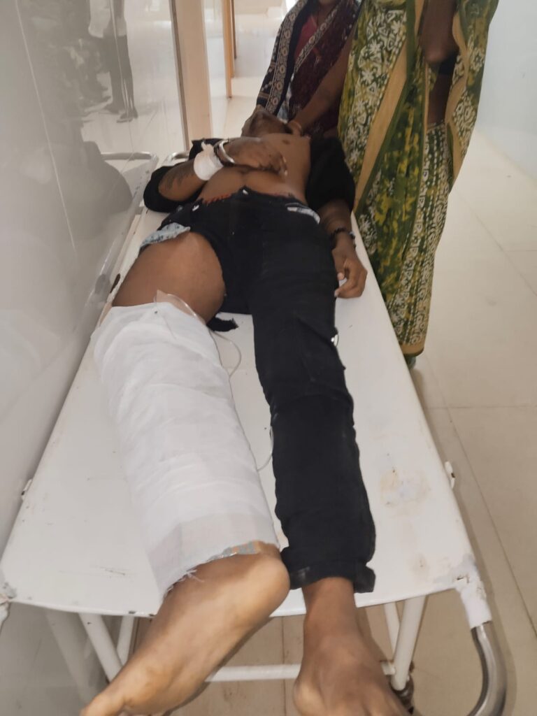 ମୋଟରସାଇକେଲ ଦୁର୍ଘଟଣାରେ ଯୁବକ ମୃତ ; ଜଣେ ଆହତ